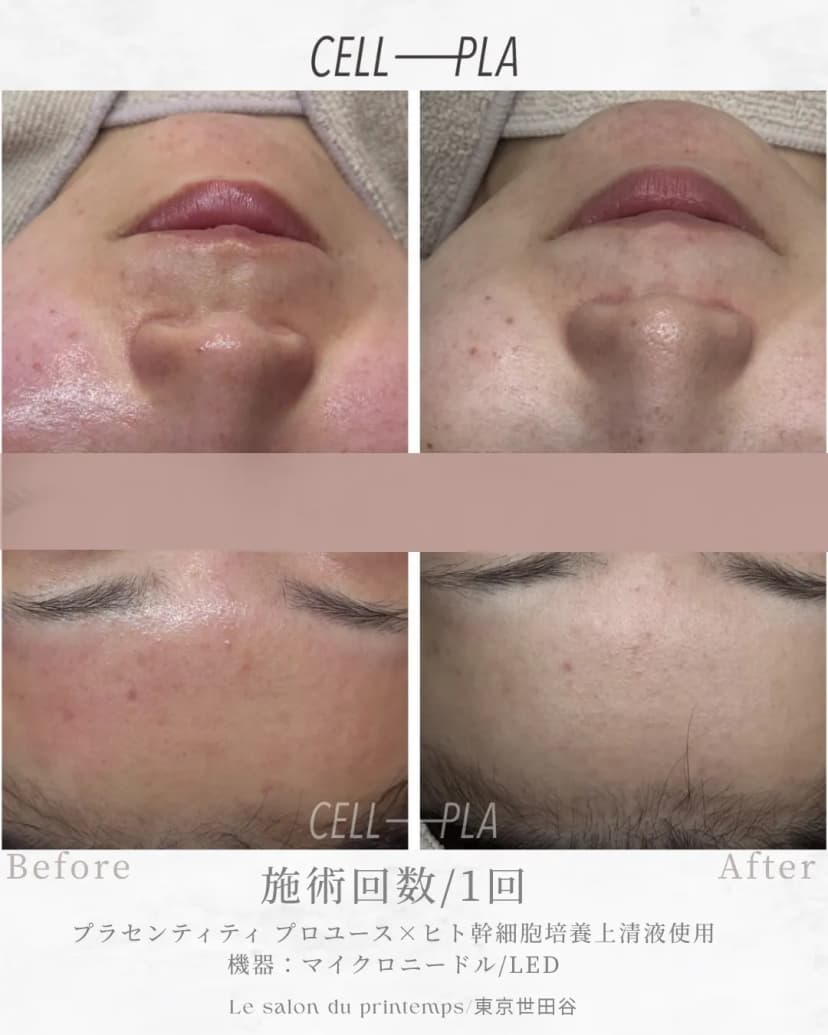 肌への効果 Before/After