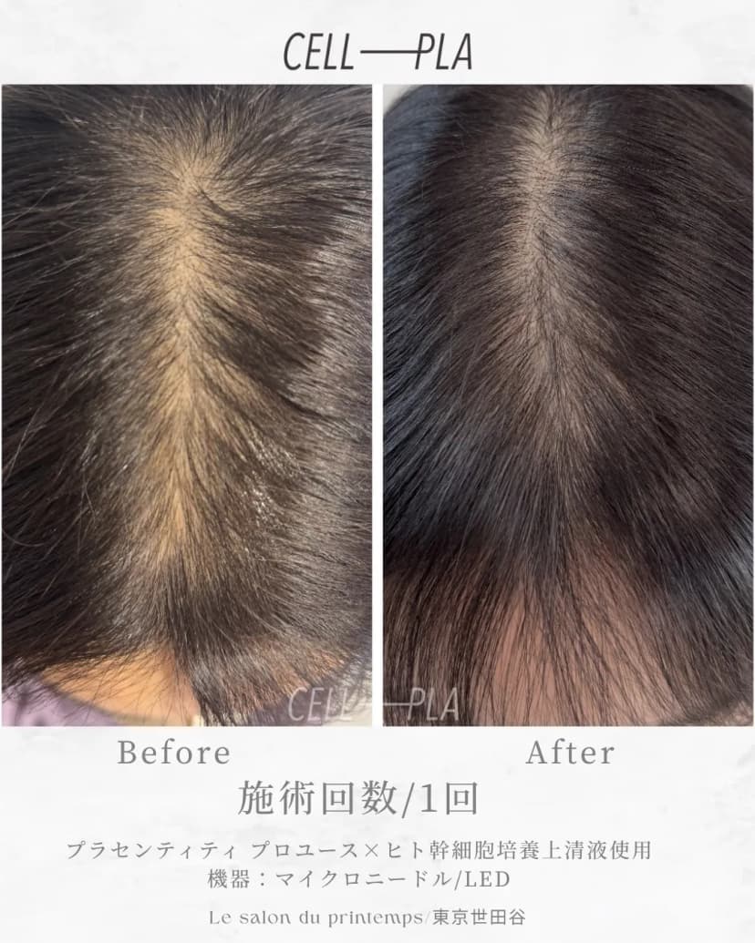 頭皮・毛髪への効果 Before/After