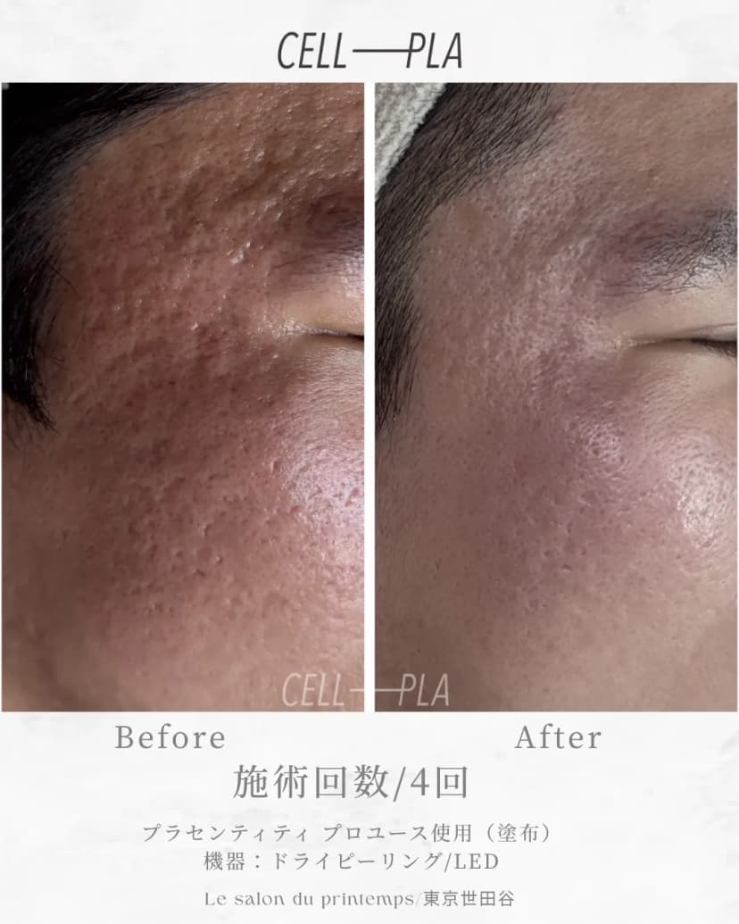 肌への効果 Before/After 2枚目