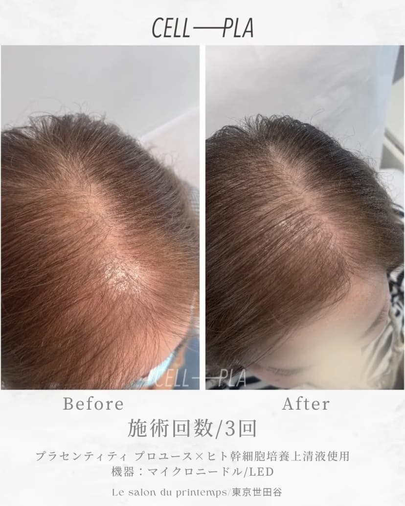 頭皮・毛髪への効果 Before/After 2枚目