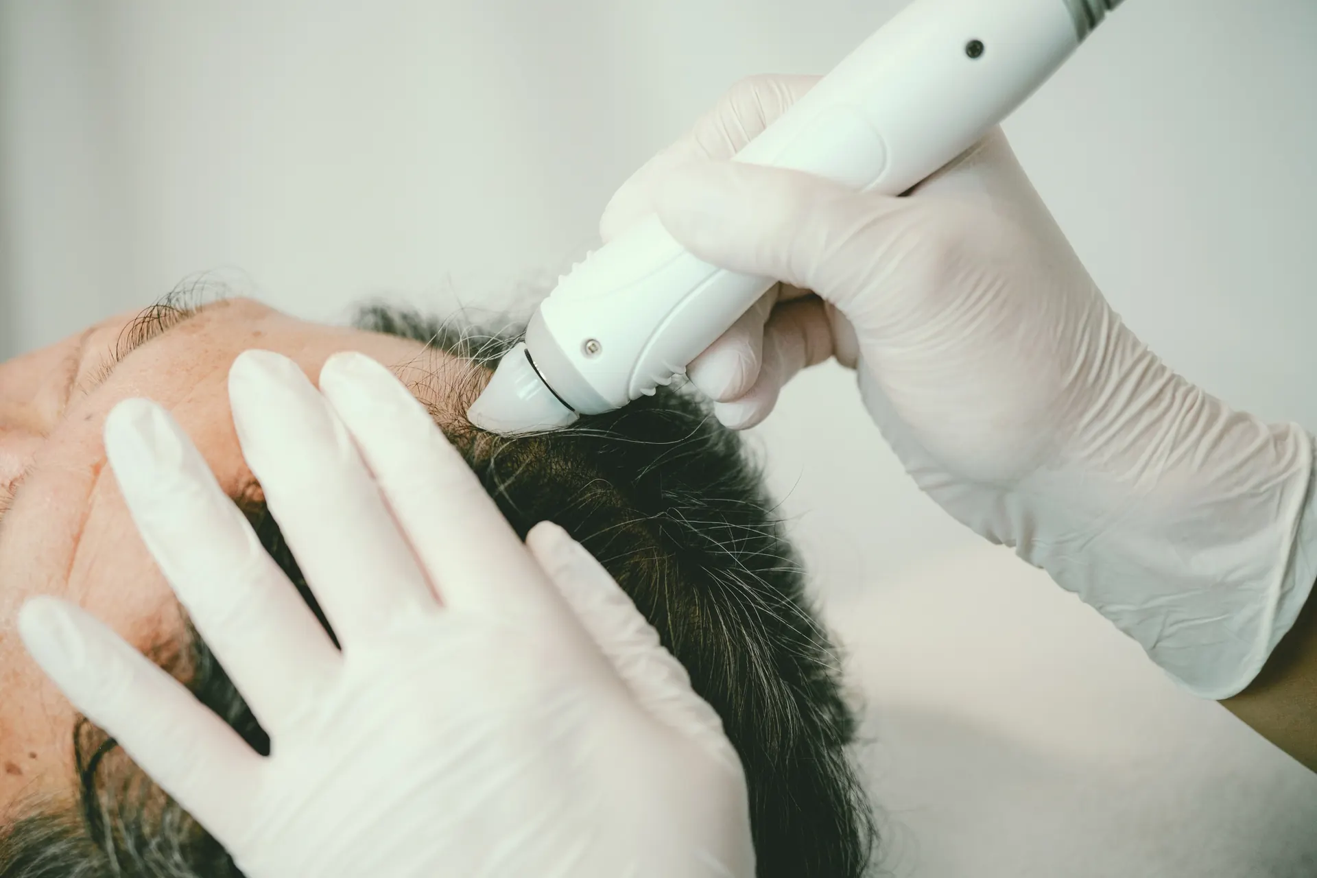 頭皮洗浄(水素ピーリング)の施術風景