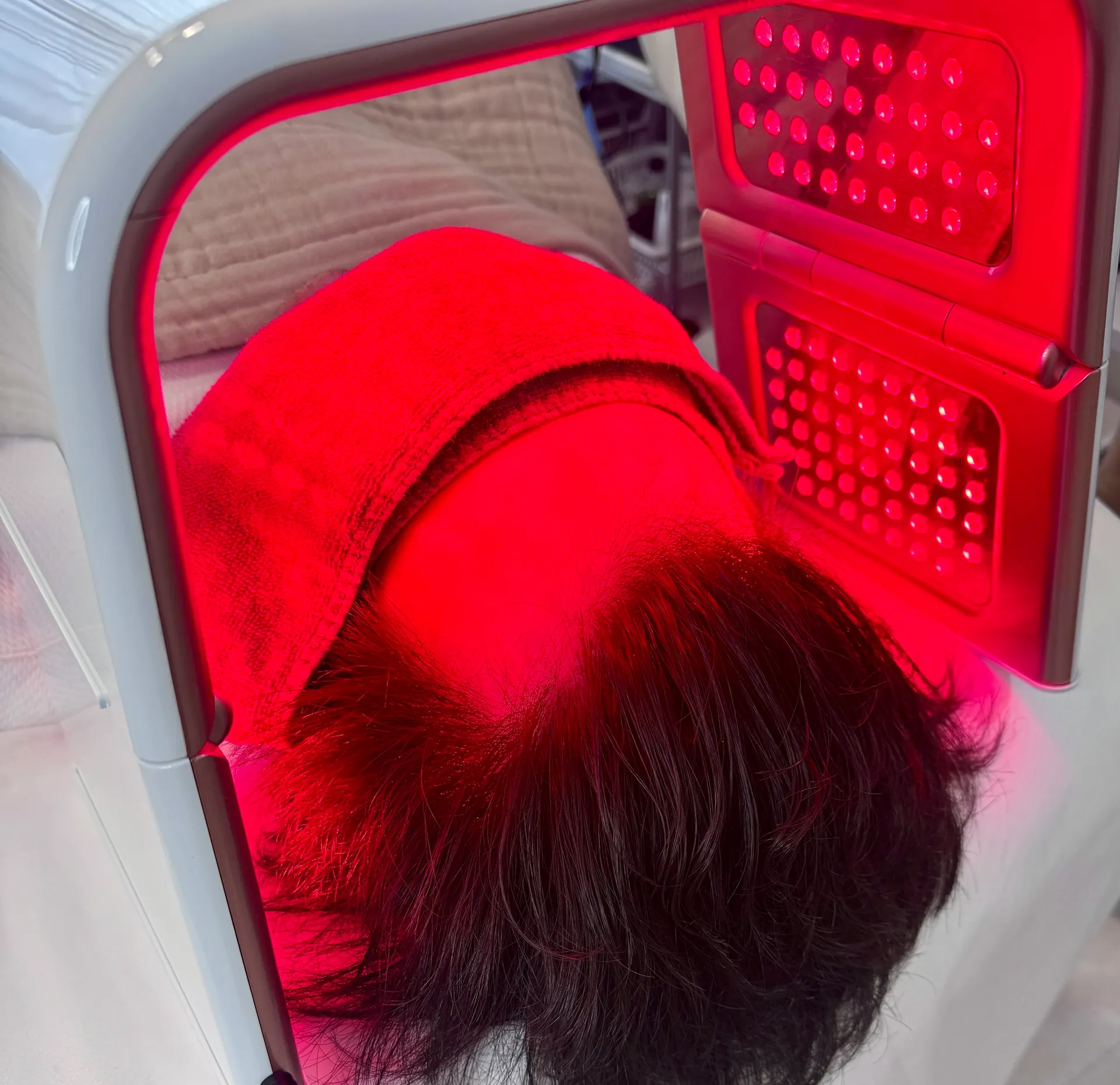 LED照射の施術風景