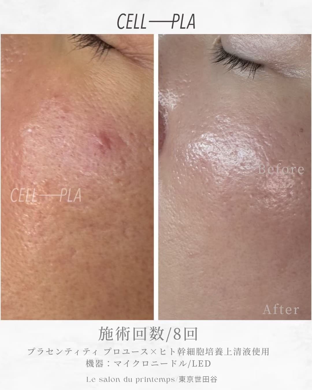 施術8回 Before & After