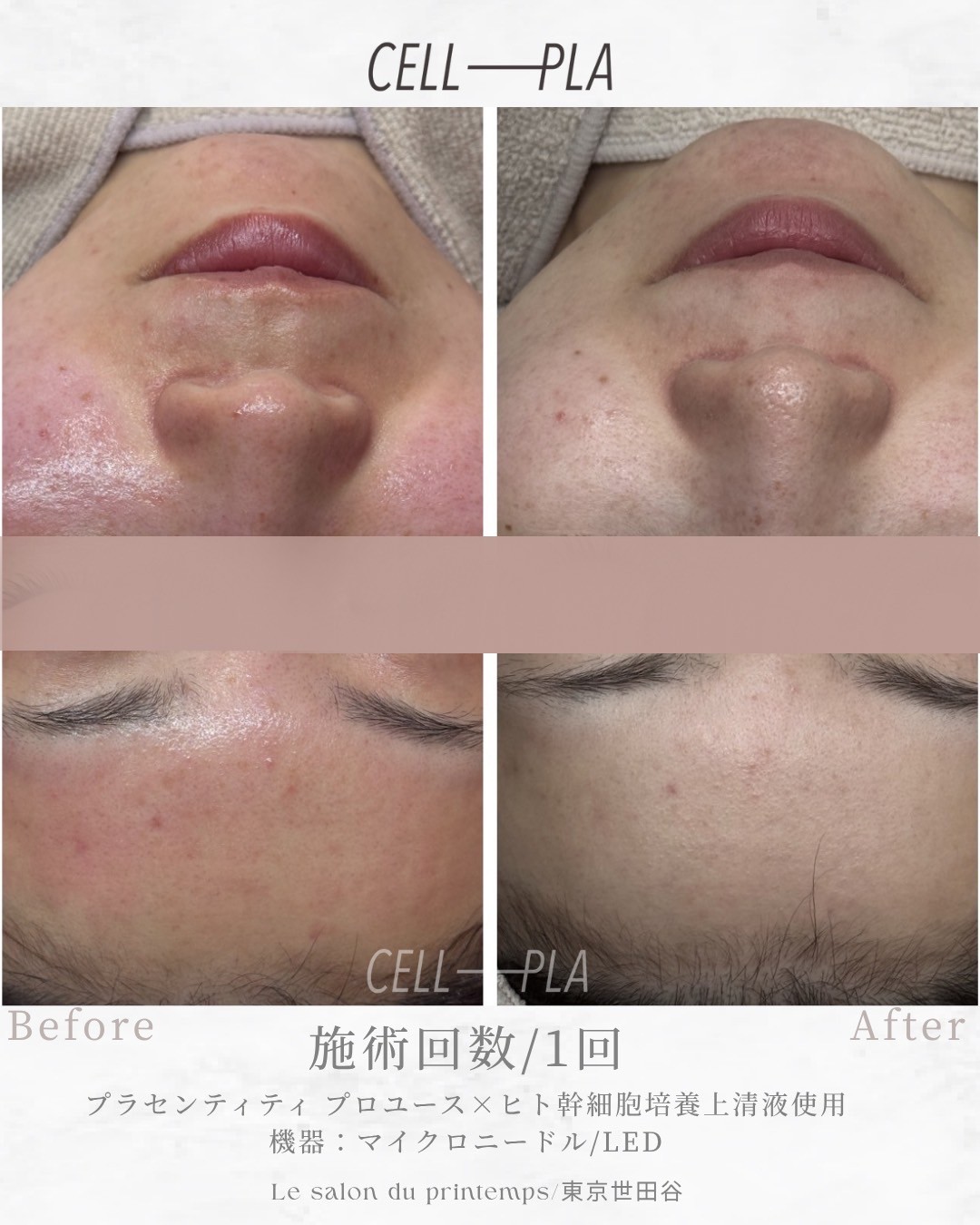 肌への効果 Before/After